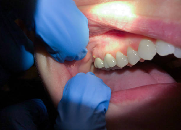 Best Pediatric Emergency Dentist in Allendale, MI