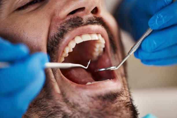 Best Walk-In Emergency Dentist in Allendale, MI
